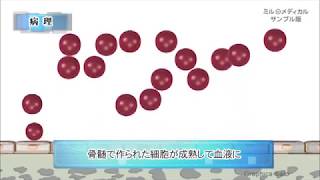 急性白血病／2分で分かる医療動画辞典　ミルメディカル