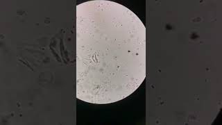 Urine sample: WBC above normal #laboratory #mls #cls #medtechstudent #microscope #medtech #urine