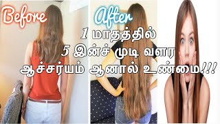 ஒரு மாதத்தில் 5 inch முடி வளர இதை செய்யுங்கள் Unbelievable!!Grow 5 Inches Hair In A Month(100%works)