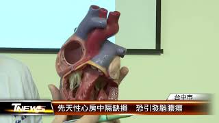 先天性心房中隔缺損  恐引發腦膿瘍 │T-NEWS聯播網