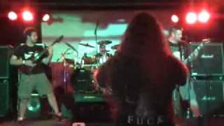 Atrocious Abnormality - (live) 8/29/10 \