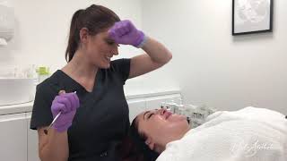 Wow Facial at Halo Aesthetics - Milton Keynes