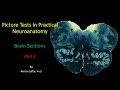 Picture Test in Neuroanatomy Brain Sections 3