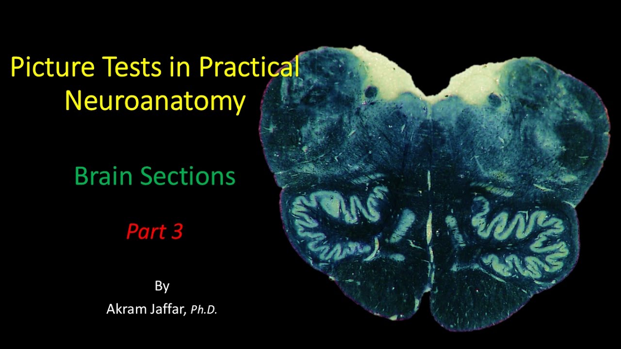 Picture Test In Neuroanatomy Brain Sections 3 - YouTube