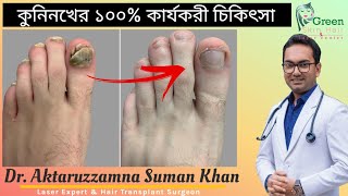 কুনি নখের ১০০% কার্যকরী চিকিৎসা || Dr. Aktaruzzaman Suman Khan || Green Skin Hair \u0026 Laser Center