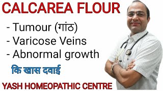 Calcarea Flour explained | Dose and symptoms | Brain tumour | varicose veins