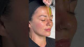 BioRePeel Peeling-Mit Liebe zum Detail Kosmetiksalon Berlin 🌿 #skincare #shortsvideo #biorepeel