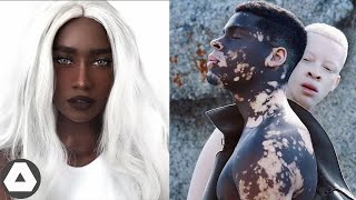 10 Unusual Black People With Rare Beauty That Shocked the World