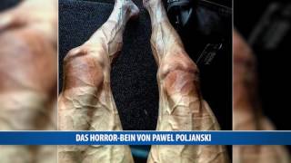 Das Horror-Bein von Pawel Poljanski