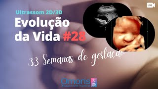 ഗർഭാവസ്ഥ 33 ആഴ്ചകൾ - ഒബ്‌സ്റ്റട്രിക് അൾട്രാസൗണ്ടിൽ 3D പ്രിന്റിംഗ് - ജീവിതത്തിന്റെ പരിണാമം #28