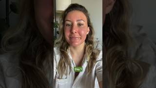 Cosmelan Depigmentation Peel - day 7 #shorts #cosmelan #pigmentation #mesoestetic #skincare