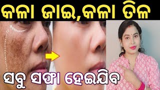 କେତେବି ପୁରୁଣା Pigmentantion,Dark spots Freckles,Melasma ଅଛି,ଏହି treatment ରେ  ଠିକ ହେବ#parineetaodia