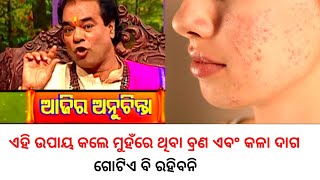 ମୁହଁରେ ବ୍ରଣ ଏବଂ କଳା ଦାଗର ଉପଚାର | Ajira Anuchinta | Sadhubani Anuchinta | Jitu Das Anuchinta |