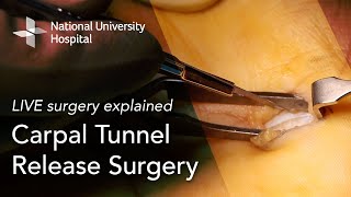LIVE Surgery Explained: Carpal Tunnel Release Surgery