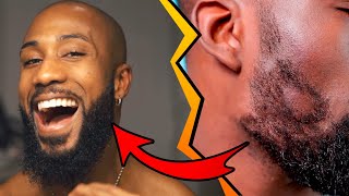 COMMENT DENSIFIER LA BARBE ET COMBLER LES TROUS DANS SA BARBE (toppik VS teinture à barbe)