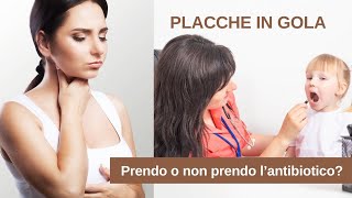 Placche in gola: prendo o non prendo l'antibiotico?