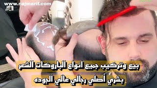 الحل النهائي لمشكله الصلع برستيج الشعر بشري أصلي