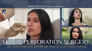 Septal Perforation Repair Surgery for Singer with Hole in Nasal Septum by Dr. Jason S. Hamilton