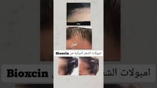 امبولات علاج التساقط و ملأ الفراغات و و تقوية البصيلات 😍 من الماركة التركية المعروفة عالميا Bioxcin