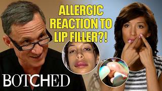 Teen Mom's Farrah Abraham Had A Terrifying Allergic Reaction to Filler | Rejected By Botched | E!