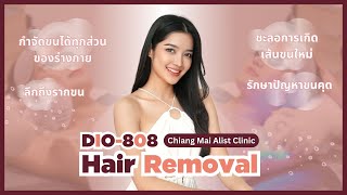 เลเซอร์ กำจัดขน แขน รักแร้ ขา  ฉบับผู้หญิง กับ คุณกานต์ | Chiang Mai ALIST Clinic