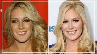 Heidi Montag Amazing Transformation | Before and After Plastic Surgery