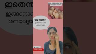 ഞാൻ ഇതുവരെ dentist നെ visit ചെയ്തിട്ടില്ല. #shorts #malayalam #trending