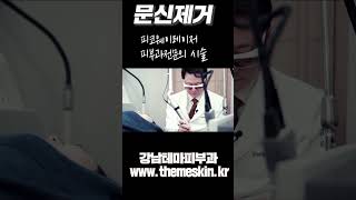 문신제거 피코웨이레이저 피부과전문의 시술 강남테마피부과 #Shorts