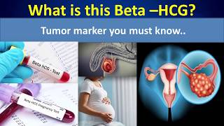 What is this Beta -HCG(tumor marker you must know).