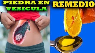 remedios caseros para eliminar piedras de la vesicula