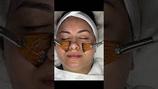 Best HydraFacial in Dallas Unveiled | Sanjiva Med Spa Glow