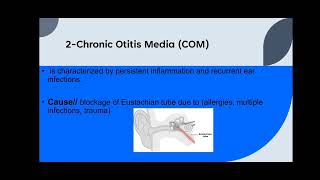 وانەی هەشتەم ئینتیهابی گوێی ناوەڕاست(otitis media)