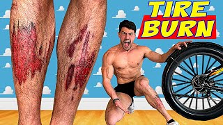 Creating the WORST TIRE BURN INJURY of all Time *MY WORST INJURY EVER* | Bodybuilder VS Rubber Burns