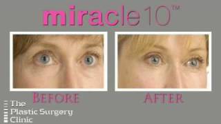 Laser Wrinkle Removal  | The Plastic Surgery Clinic