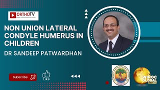 Non Union Lateral Condyle Humerus in Children  - Dr Sandeep Patwardhan