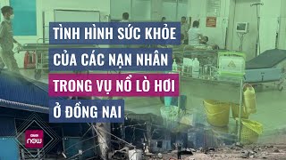Cập nhật liên tục về hình sức khỏe các nạn nhân bị thương trong vụ nổ lò hơi ở Đồng Nai | VTC Now