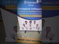 CO Trauma Course at Delhi. | Conceptual Orthopedics