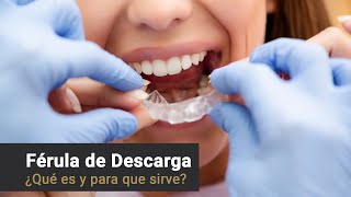 Provenza Clínica Dental - Férula de descarga