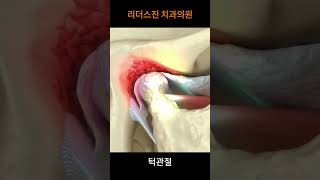 [리더스진 치과의원] 턱관절 모습 ASMR ㅣ턱관절을 알기 위해서는 기본 모습부터 알아야죠^^