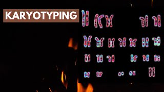 Karyotyping | Human Genetics | Cytogenetics