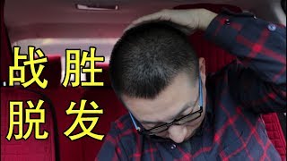 我是如何战胜脱发的？对即将秃头的朋友几个建议(小叔TV第005期)