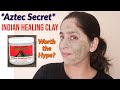 Aztec Secret Indian Healing Clay Review | Raw and Honest Review | Ishita Bathla