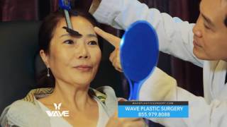 WAVE Medical Minute -  Endoscopic Brow and Midface Lift with Dr. Lee