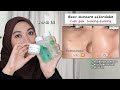 Review 21 Hari Pemakaian - KUPAS TUNTAS Reglow by Dr. Shindy Putri