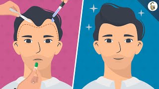 Hair Loss Treatments For Men (According To Science)