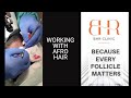 fue technique working with afro hair bisanga hair transplant clinic bhr clinic