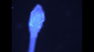 Staining Hairs with DAPI
