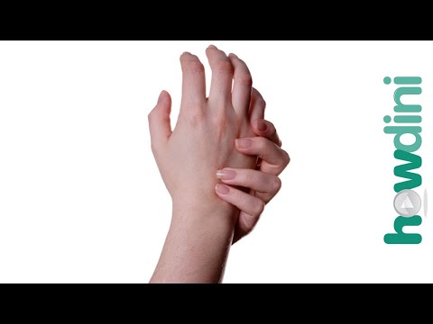 How to treat a burn - How to treat burns at home How to treat a burn - How to treat burns at home