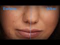 High End Skin Retouching (photoshop) | M.Tafakar |