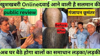 Online दवाई आने वाली हैl Salman Salon Mandoli |घर बैठे आएंगे बाल | Alopecia |Alopecia Areata l Bald